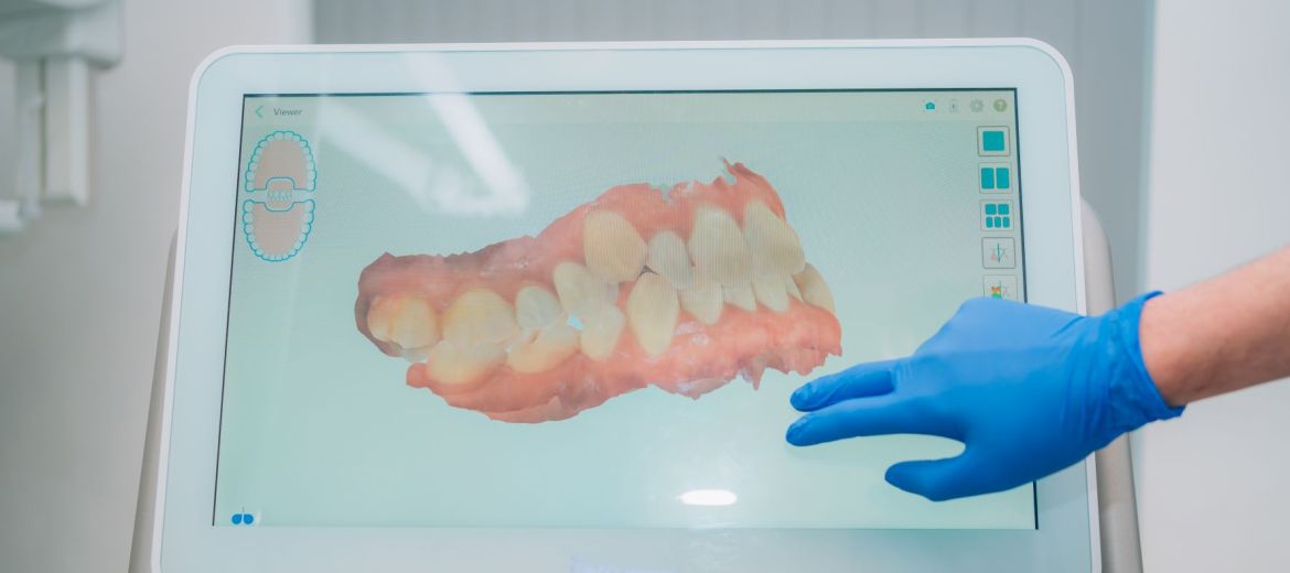 3d digital scan