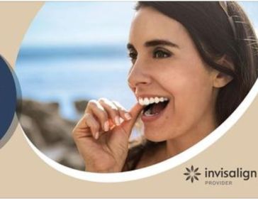 invisalign event