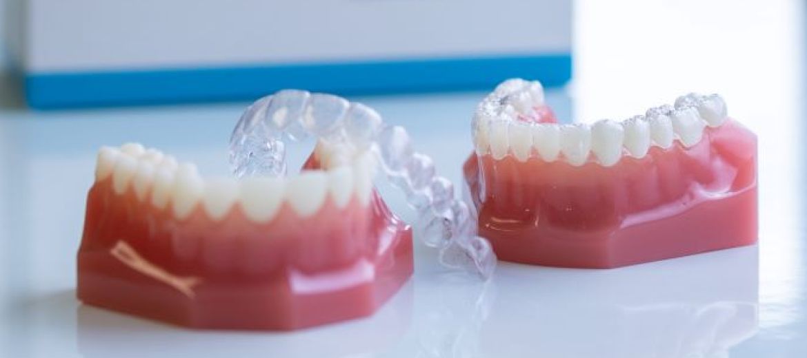 Invisalign