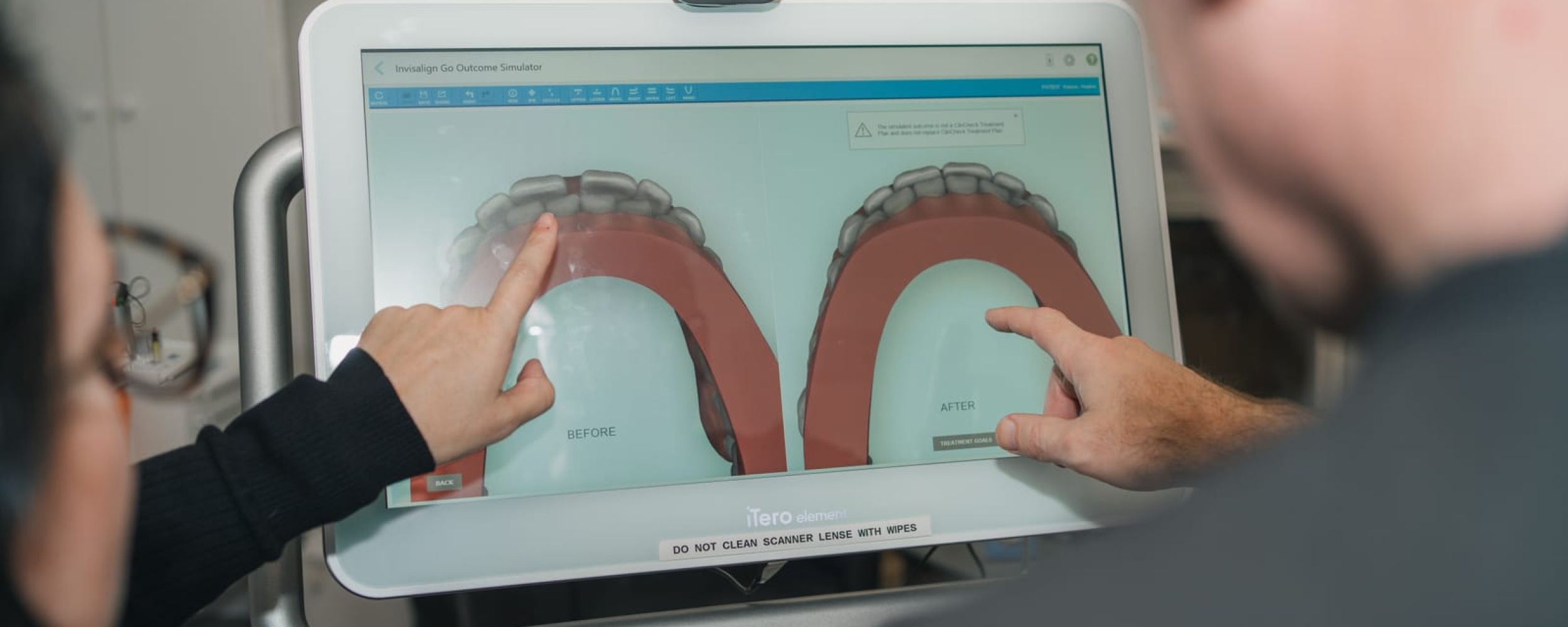 Invisalign® clear aligners